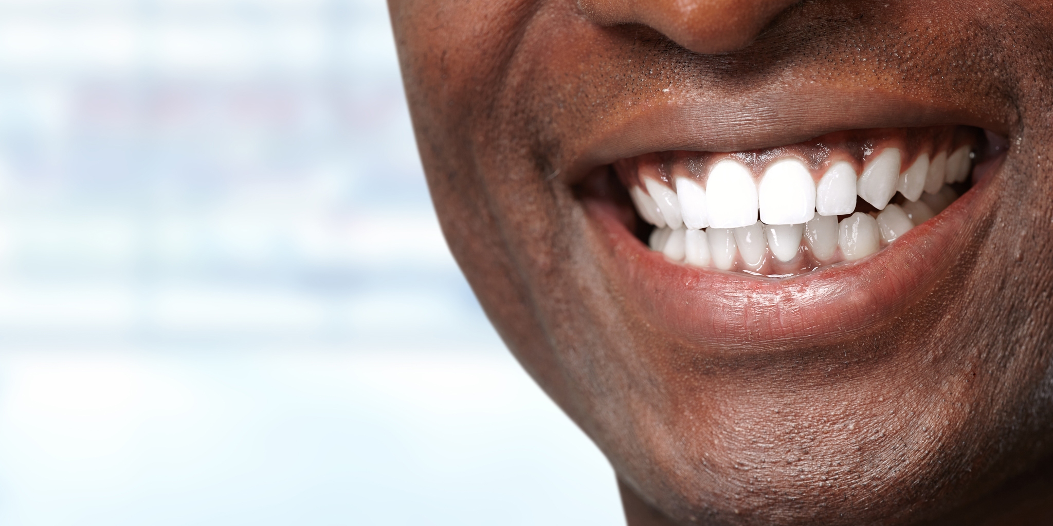 Man smiling with newly cleaned white teeth